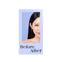 kkonya - Before After